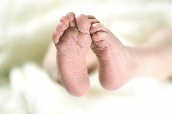 California new measles case raises concern and this is how you can protect your child