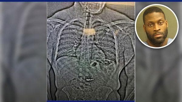 Florida man swallows $769K in stolen diamonds but his escape plan is hard to digest