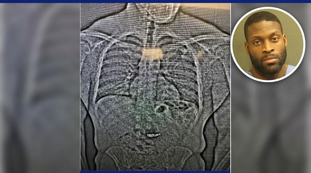 Florida man swallows $769K in stolen diamonds but his escape plan is hard to digest